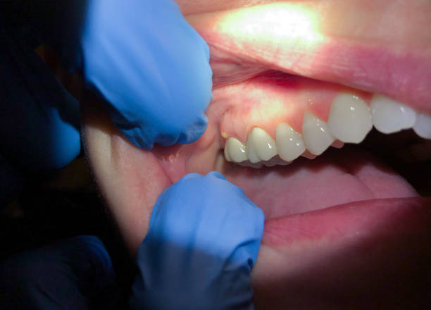 Best Urgent Care for Lost Fillings or Crowns in Parshall, ND